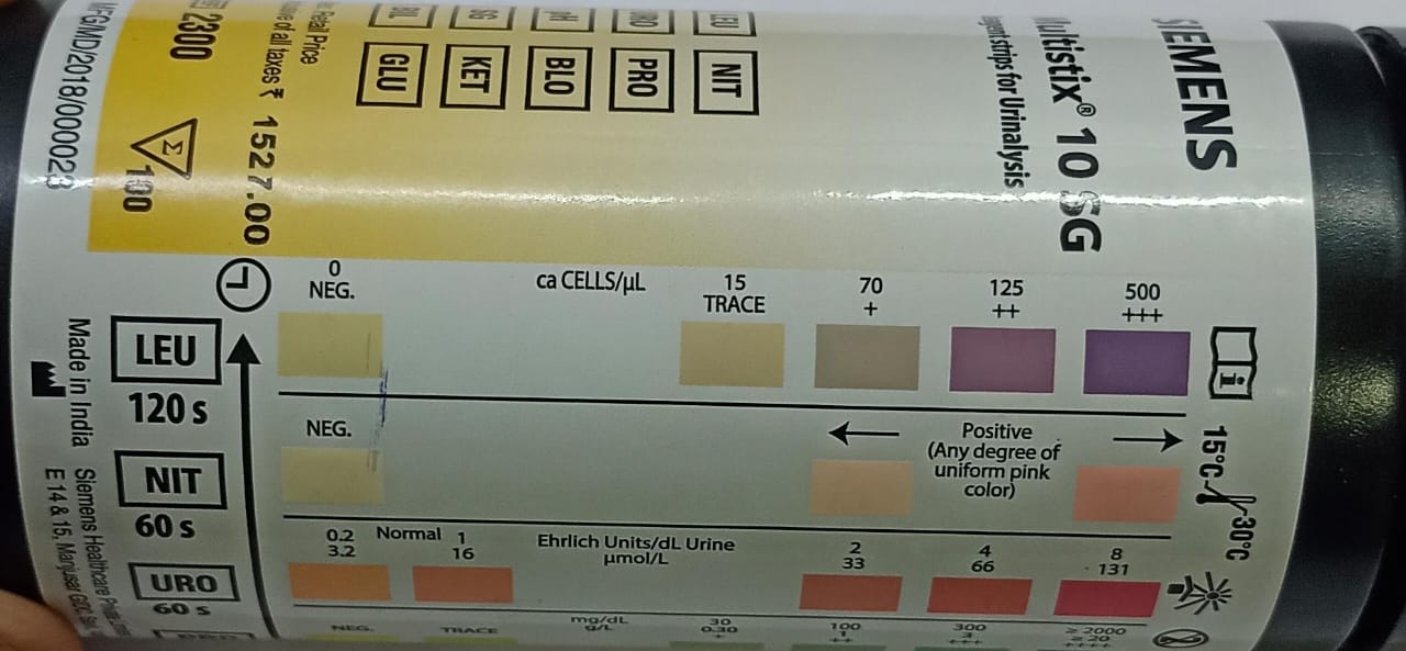 Urine Leukocyte Esterase Test Clinical Laboratory Guide 2629